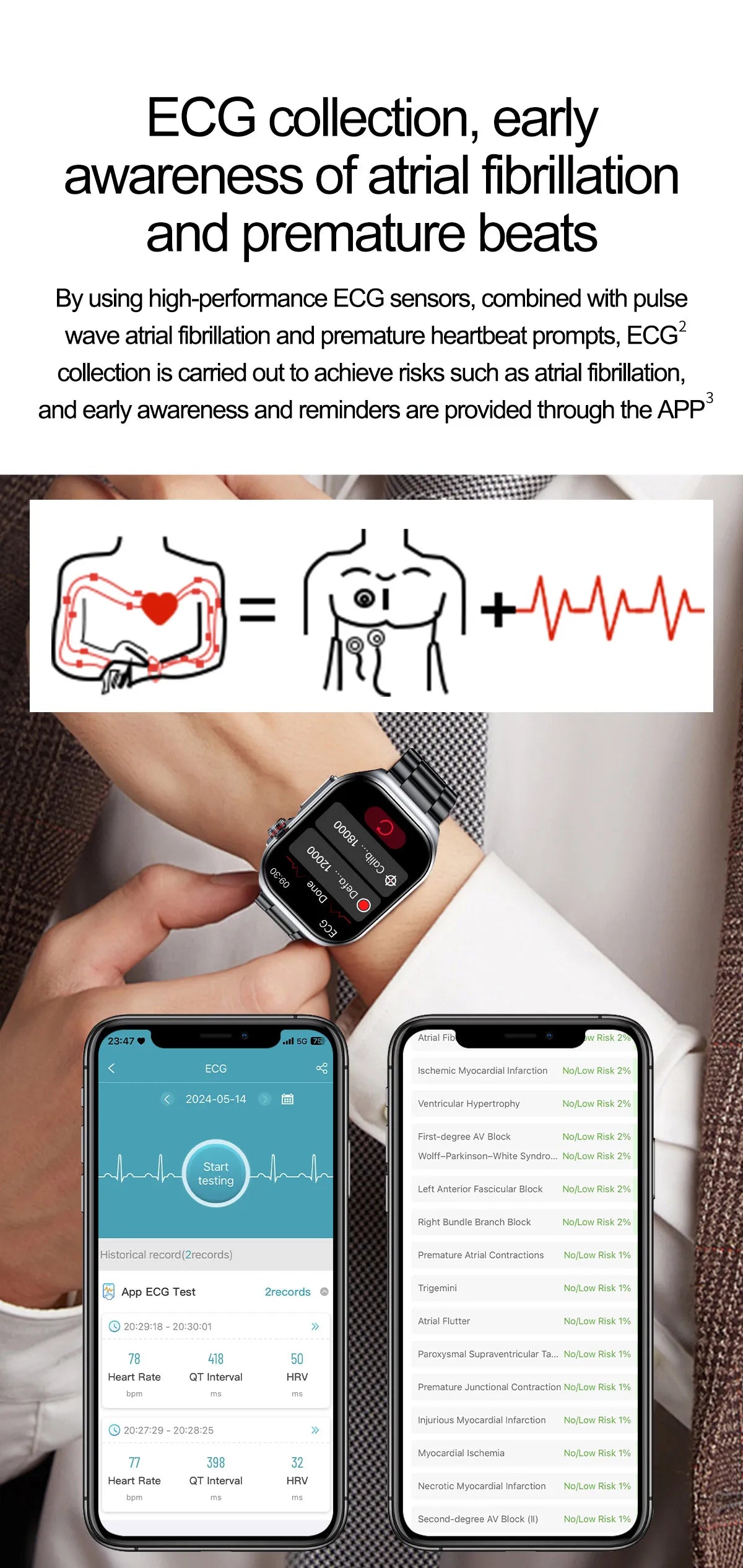 LunaWatch X™ Pro 2.04" – Montre Connectée AMOLED, ECG, NFC, Composition Corporelle, IP68, 7 Bracelets