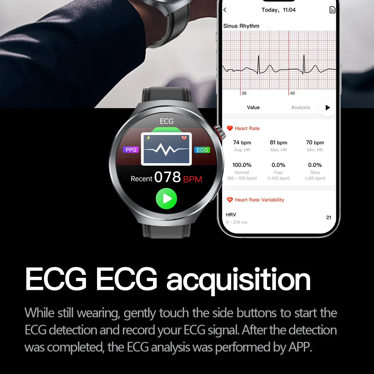 LunaWatch X™ ECG Pro NFC – Montre Connectée AMOLED 1.73", ECG, NFC, IP68, SOS, Appels BT, 530mAh